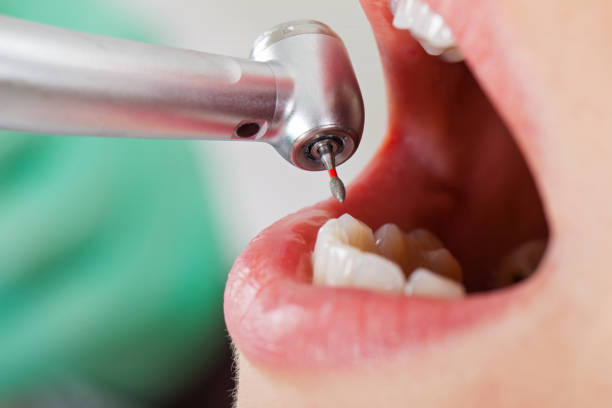 Best Knocked-Out Tooth Emergency  in Bargaintown, NJ